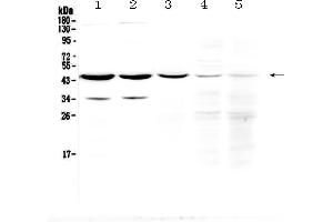 Western blot analysis of HOMER3 using anti-HOMER3 antibody . (HOMER3 抗体  (AA 282-360))
