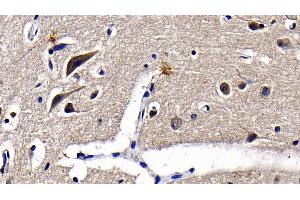 Immunohistochemistry (IHC) image for anti-Toll-Like Receptor 3 (TLR3) (AA 404-532) antibody (ABIN7434491)