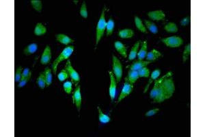 Immunofluorescent analysis of Hela cells using ABIN7147451 at dilution of 1:100 and Alexa Fluor 488-congugated AffiniPure Goat Anti-Rabbit IgG(H+L) (CEP25 (AA 40-293) 抗体)