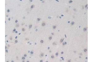 Detection of BRD8 in Mouse Brain Tissue using Polyclonal Antibody to Bromodomain Containing Protein 8 (BRD8) (BRD8 抗体  (AA 797-951))