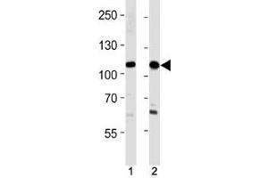 SALL4 antibody western blot analysis in 293,HeLa lysate. (SALL4 抗体  (AA 1009-1039))