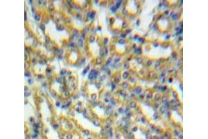 Used in DAB staining on fromalin fixed paraffin-embedded Kidney tissue (HSPD1 抗体  (AA 28-573))