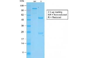 SDS-PAGE Analysis Purified VEGI Rabbit Monoclonal Antibody (VEGI /2052R). (Recombinant TNFSF15 抗体)