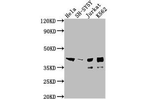 Western Blot Positive WB detected in: Hela whole cell lysate, SH-SY5Y whole cell lysate, Jurkat whole cell lysate, K562 whole cell lysate All lanes: ISL1 antibody at 1:2000 Secondary Goat polyclonal to rabbit IgG at 1/50000 dilution Predicted band size: 40 kDa Observed band size: 39 kDa (Recombinant ISL1 抗体)