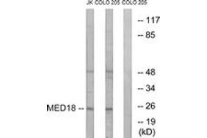 Western blot analysis of extracts from COLO/Jurkat cells, using MED18 Antibody.