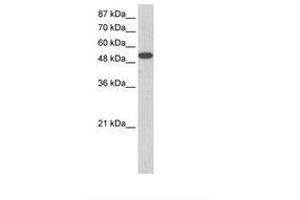 Image no. 1 for anti-Zinc Finger Protein 416 (ZNF416) (AA 90-139) antibody (ABIN202795) (ZNF416 抗体  (AA 90-139))