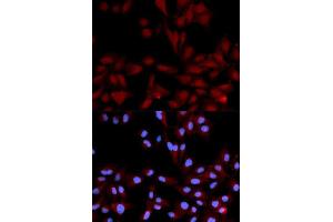 Immunofluorescence analysis of U2OS cell using Phospho-MAPK14-Y182-p antibody. (MAPK14 抗体  (pTyr182))