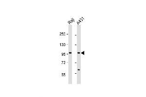 Western Blot at 1:1000 dilution Lane 1: Raji whole cell lysate Lane 2: A431 whole cell lysate Lysates/proteins at 20 ug per lane. (NFKB1 抗体  (AA 911-939))