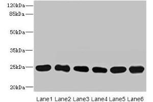 Western blot All lanes: FKBP14 antibody at 1 μg/mL Lane 1: Mouse stomach tissue Lane 2: Mouse gonadal tissue Lane 3: U937 whole cell lysate Lane 4: PC-3 whole cell lysate Lane 5: 293T whole cell lysate Lane 6: THP-1 whole cell lysate Secondary Goat polyclonal to rabbit IgG at 1/10000 dilution Predicted band size: 25 kDa Observed band size: 25 kDa (FKBP14 抗体  (AA 20-211))