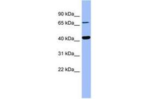 Image no. 1 for anti-4-Hydroxyphenylpyruvate Dioxygenase (HPD) (AA 179-228) antibody (ABIN6741738) (HPD 抗体  (AA 179-228))