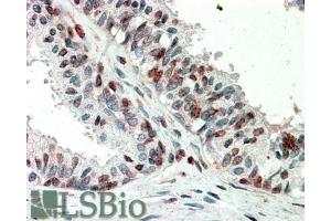 ABIN5539913 (5µg/ml) staining of paraffin embedded Human Prostate. (ZIC3 抗体  (AA 178-189))