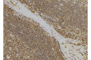 ABIN6279673 at 1/100 staining Human lymph node tissue by IHC-P. (PABPC3 抗体)