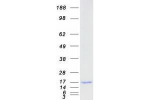 C2orf88 Protein (Transcript Variant 4) (Myc-DYKDDDDK Tag)