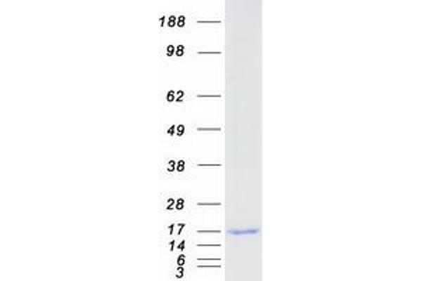 C2orf88 Protein (Transcript Variant 4) (Myc-DYKDDDDK Tag)