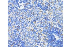 Immunohistochemistry of paraffin-embedded Mouse spleen using SDHB Polyclonal Antibody at dilution of 1:100 (40x lens). (SDHB 抗体)