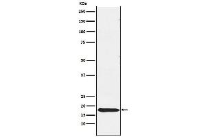 Western blot analysis of TSH beta expression in Human pituitary lysate.
