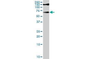 TYR MaxPab rabbit polyclonal antibody. (TYR 抗体  (AA 1-377))