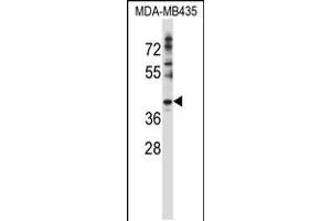 Western blot analysis in MDA-MB435 cell line lysates (35ug/lane). (DNAJC28 抗体  (C-Term))