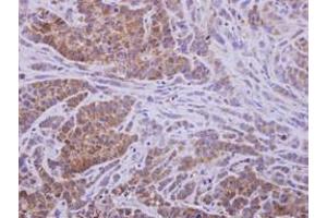 Image no. 1 for anti-Aldo-Keto Reductase Family 1, Member D1 (AKR1D1) (AA 1-326) antibody (ABIN1496548) (AKR1D1 抗体  (AA 1-326))