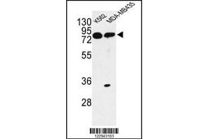 Western blot analysis of PRKAA1 Antibody in K562, MDA-MB435 cell line lysates (35ug/lane) (PRKAA1 抗体)