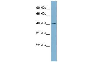 WB Suggested Anti-LASS1 Antibody Titration:  0. (LASS1 抗体  (Middle Region))
