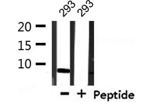 Western blot analysis of extracts from 293, using COX17 Antibody.