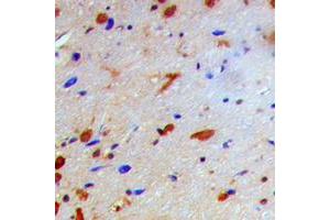 Immunohistochemical analysis of IKK beta (pT19) staining in human brain formalin fixed paraffin embedded tissue section. (IKBKB 抗体  (N-Term, pSer19))