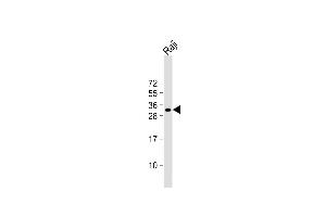 Anti-HLA-DQA1 Antibody (N-term) at 1:1000 dilution + Raji whole cell lysate Lysates/proteins at 20 μg per lane. (HLA-DQA1 抗体  (N-Term))