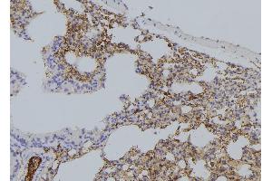 ABIN6277277 at 1/100 staining Human lung tissue by IHC-P.