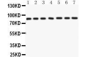 Anti- AIF Picoband antibody, Western blotting All lanes: Anti AIF  at 0. (AIF 抗体  (C-Term))