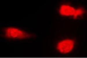 Immunofluorescent analysis of JNK1/2/3 (pT183) staining in NIH3T3 cells. (JNK 抗体  (pSer183))