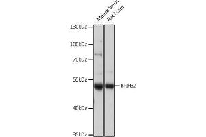 Western blot analysis of extracts of various cell lines, using BPIFB2 antibody (ABIN7265907) at 1:1000 dilution. (BPIL1 抗体  (AA 40-340))
