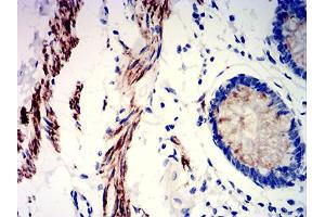 Immunohistochemical analysis of paraffin-embedded rectum tissues using PRKAG3 mouse mAb with DAB staining.