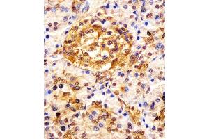 (ABIN652121 and ABIN2840556) staining ESRP1 in human pancreas tissue sections by Immunohistochemistry (IHC-P - paraformaldehyde-fixed, paraffin-embedded sections). (ESRP1 抗体  (AA 182-211))