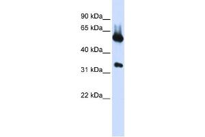 WB Suggested Anti-ALAS2 Antibody Titration:  0. (ALAS2 抗体  (N-Term))