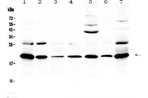 Western blot analysis of Ccl19/MIP-3 beta using anti-Ccl19/MIP-3 beta antibody . (CCL19 抗体  (AA 26-108))
