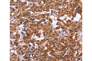 Immunohistochemistry of Human brain  using MSH4 Polyclonal Antibody at dilution of 1:30 (MSH4 抗体)
