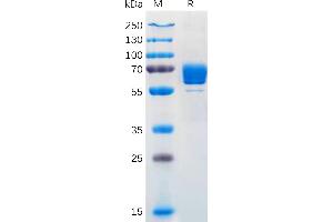 SDS-PAGE (SDS) image for Colony Stimulating Factor 1 (Macrophage) (CSF1) (AA 33-255) protein (mFc Tag) (ABIN7092730)