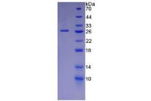 SDS-PAGE analysis of Mouse Laminin alpha 5 Protein. (Laminin alpha 5 蛋白)