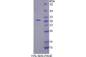 Image no. 1 for Midline 1 (MID1) (AA 1-212) protein (His tag) (ABIN4989412)