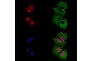ABIN6256915 and ABIN6274184 staining  cells by IF/ICC. (ATF7 抗体  (N-Term))