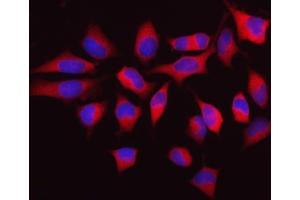 IF analysis of MTHFD1 using anti-MTHFD1 antibody (ABIN7600631).