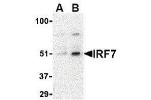 Western Blotting (WB) image for anti-Interferon Regulatory Factor 7 (IRF7) (Center) antibody (ABIN2475145) (IRF7 抗体  (Center))