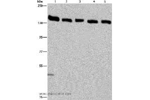 Western blot analysis of Hela cell and human testis tissue, A549, Jurkat and K562 cell, using IPO4 Polyclonal Antibody at dilution of 1:550 (Importin 4 抗体)