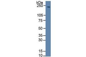 Rabbit Capture antibody from the kit in WB with Positive Control: Sample Rat brain tissue. (SLIT1 ELISA 试剂盒)