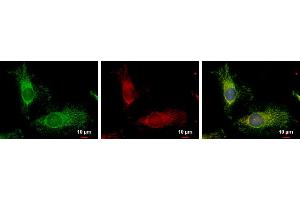 ICC/IF Image FIS1 antibody detects FIS1 protein at mitochondria by immunofluorescent analysis. (Fission 1 抗体  (full length))