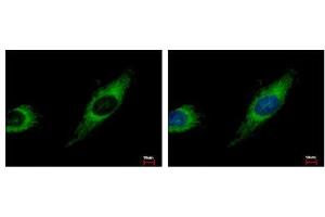 Image no. 3 for anti-Transforming Growth Factor beta Regulator 4 (TBRG4) (AA 1-328) antibody (ABIN1501337) (TBRG4 抗体  (AA 1-328))
