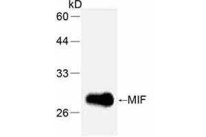 Western Blotting (WB) image for anti-Macrophage Migration Inhibitory Factor (Glycosylation-Inhibiting Factor) (MIF) (full length) antibody (ABIN1854219) (MIF 抗体  (full length))