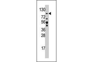 Western blot analysis of USP33 polyclonal antibody  in T-47D cell line lysate (35 ug/lane). (USP33 抗体  (C-Term))