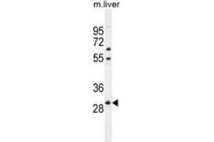 Western blot analysis in mouse liver tissue lysates (35ug/lane) using PHOX2B  Antibody .